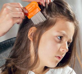 4 Answers to Your Super Lice Questions